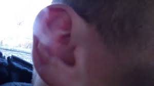 Irritants (particularly cigarette smoke) respiratory infections. Ear Smoking Lad Blow Smoke Out The Ear Youtube