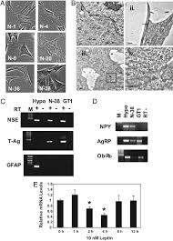 Immortalized, clonal cell lines express neuronal cell markers but... |  Download Scientific Diagram