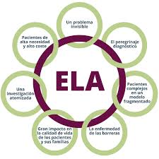 La ela es considerada como una enfermedad rara, a pesar de que se trata de la tercera enfermedad neurodegenerativa en incidencia, tras el alzheimer y uno de cada 10 casos de esclerosis lateral amiotrófica (ela) se debe a un defecto genético. Fundacion F Luzon A Twitter La Ela Es Una Compleja Enfermedad Que Requiere Mayor Visibilidad Enfermedadesinvisibles