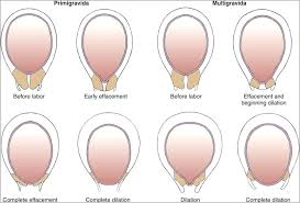 Pregnancy Dilation Diagram Diagram Schematic Ideas