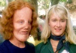 The film's tender death scene was a lie" Before She Died, Rocky Dennis's  Mom FINALLY Broke Silence About Rocky Dennis And It's Not Good The world  remembers Rocky Dennis as the boy