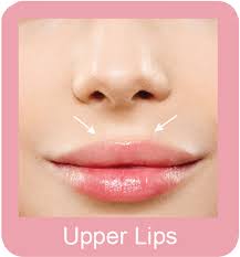 If you are asking, how can i remove my upper lip hair? Permanent Hair Removal Upper Lips Hair Removal Of Lips Permanent Hair Removal Small Area Selangor Malaysia