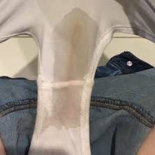 This is considered healthy unless the discharge is lumpy or accompanied by a strong odor. Clear Watery Discharge White Vaginal Discharge