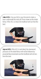 Image result for Lever Test