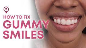 How to fix a gummy smile with braces. The Best Solution To Your Gummy Smile Dr Reuben Sim Youtube