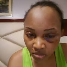 Nollywood actress, mercy aigbe's former husband, lanre gentry has showered praises on his new wife as she marked her birthday. Breaking Gists On Entertainment Mercy Aigbe Posts Old Photo Of When Her Ex Husband Almost Blinded Her