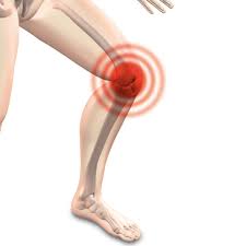 One of the primary indicators of a meniscus tear is the knee locking up. Knee Swelling After Meniscus Surgery