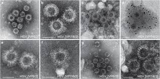 Search for herpes 1 vs herpes 2. Electron Micrographs Of Herpes Simplex Virus Type 1 Hsv 1 Amplicon Download Scientific Diagram