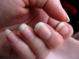 Your toenail can become infected in a number of ways, including fungal infections or even calluses caused by your shoes. What S Up With That Your Fingernails Grow Way Faster Than Your Toenails Wired