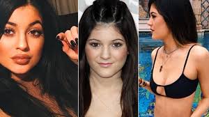 Kylie jenner was raised in a world of wealth and privilege, getting access to amenities and luxuries that many people could only dream of. Plastic Surgeons Weigh In On Kylie Jenner S Dramatic Transformation Did She Go Under The Knife
