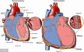 The site owner hides the web page description. å°åº·è¯´ å¿ƒè‚Œç‚Žçš„ç—‡çŠ¶æ˜¯ä»€ä¹ˆ ä¼šæœ‰åŽé—ç—‡å— æ¯æ—¥å¤´æ¡