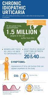 Ciu You Educational And Management Information On Chronic Idiopathic Urticaria A Form Of Chronic Hives Chronic Hives Idiopathic Urticaria Urticaria