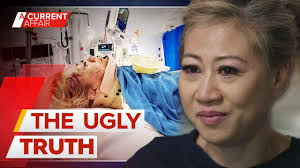 The ugly side of workers’ compensation