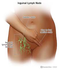 Image result for sore skin in the groin area