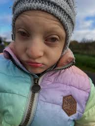 Simone Braunsdorf-Kremer (@jonathan_ein_leben_mit_mopd1) • Instagram photos  and videos