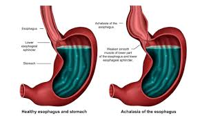 Image result for esophagus