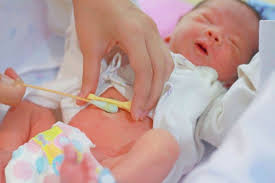 In the meantime, treat the area gently: Umbilical Cord Care For Newborns