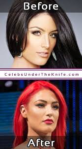 Eva Marie Nose Job Before After Surgery Celebsundertheknife Celebs Celebrity Plasticsurgery Celebritysurgery N Celebrity Surgery Nose Job Plastic Surgery