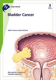 It's important to consider the benefits and drawbacks of relieving phase 4 bladder cancer since treatments come with negative effects and. Fast Facts Bladder Cancer Karger Publishers