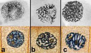 Maybe you would like to learn more about one of these? Function And Stages Of Mitosis