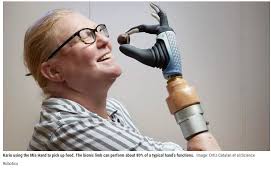mano biónica