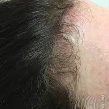 The hair follicle and the hair shaft are what make up each hair. Find Out How Fast Your Hair Grows In The Anagen Phase