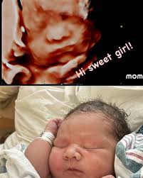 Wonder Baby 3D/4D Ultrasound