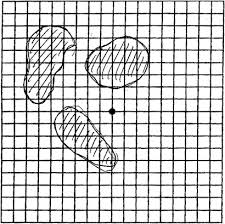 Left Eye Amsler Grid Showing Scotomas At Presentation