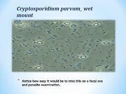 Hominis (formerly known as c. Medical Parasitology Lab Cryptosporidium Parvum Infect Human And