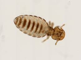 Image result for Trichoscypha lucens