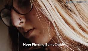 Being sore and a little red after getting a nose piercing is completely normal. Nose Piercing Bump Inside Nose Causes Treatment