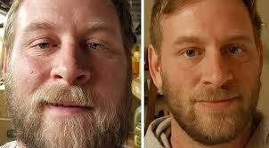 These Before And After Photos Show What Happens When You Quit Drinking Alcohol Quit Drinking Alcohol Quitting Alcohol Quit Drinking