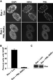 Doesn't stop many from doing just that though. Pml Rar Disrupts Pml Bodies And Formation Of Sahf A Wi38 Cells Download Scientific Diagram