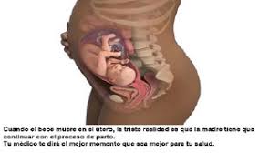 Infogen Cuales Son Los Sintomas Tempranos De Una Muerte Fetal