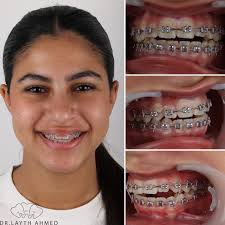 DrLayth Ahmed (@dr.laythahmed) • Instagram photos and videos