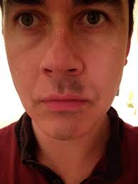Its progression is often sporadic and can seem capricious. Losing And Regaining My Facial Hair During 2012 From Hair To Eternity