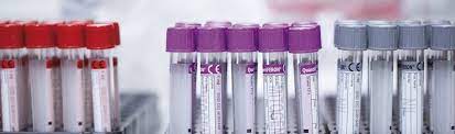 Quantiferon tb gold® test is a screening test for tuberculosis. Quantiferon Tb Gold Quantiferon