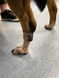 Image result for toe amputation