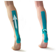 Image result for Taping for Soleus and Achilles