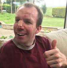 Britain's Got Talent Lost Voice Guy injures himself in fall before final