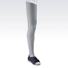 The device is in essence a bivalved copolymer full foot enclosure ankle foot orthosis with a rocker bottom sole built on the device. P T B Orthosis Okm