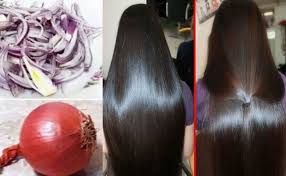 فوائد زيت البصل و3 وصفات لزيادة طول الشعر Hair Styles Hair Beauty