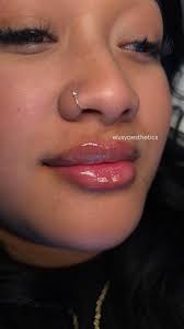 Facial balance procedures cost varies. What was your experience?