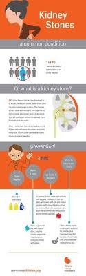 Health Tips For Kidney Stones Kidney Stones Kidney Health Kidney Stones Remedy