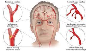Called the clinic and was told dr sng is overseas now. Dr Sng Kim Hock Neurologist Brain Physician Teleme Doctor