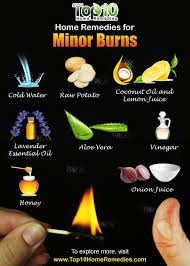 Home Remedies For Minor Burns What Works Emedihealth Home Remedies For Burns Natural Headache Remedies Burns Treatment