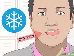 Cara menghilangkan bibir hitam dan kering secara alami berikutnya adalah dengan menggunakan kunyit. 3 Cara Untuk Menyingkirkan Area Gelap Di Sekitar Mulut Wikihow