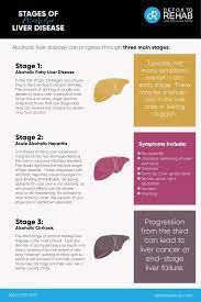 Most primary liver cancers begin in liver cells (hepatocytes). Official Symptoms Of Liver Disease Guide Alcoholic And Non Alc Wrcbtv Com Chattanooga News Weather Amp Sports