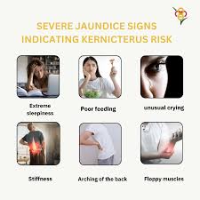Image result for Kernicterus