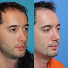 Profile for Romo Plastic Surgery